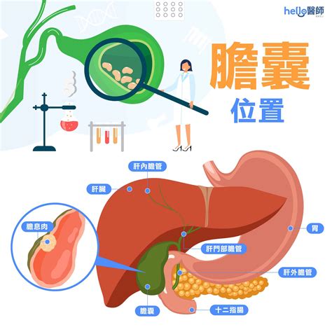 陰莖長息肉